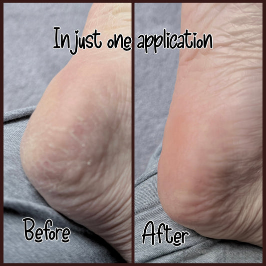 You don’t have to live with dry skin this winter